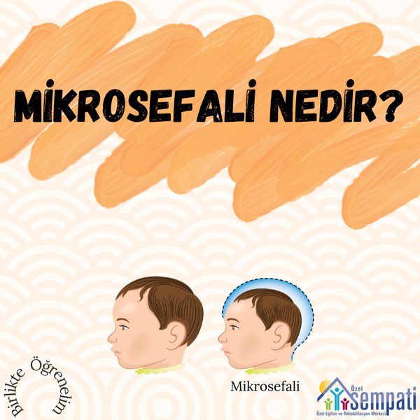 Mikrosefali Nedir? — Birlikte Öğrenelim